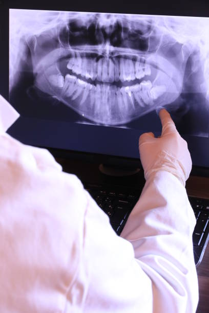 Best Emergency Dentist for Lost Fillings or Crowns in Ceres, CA
